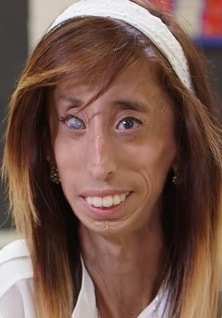 Lizzie Velasquez